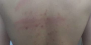 Brutal golpiza a cuatro presos políticos en Yare II exige respuesta inmediata