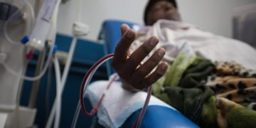 Pacientes renales perjudicados por los prolongados apagones en Trujillo
