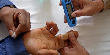 El metabolismo de las células predispone más a los hombres diabéticos a padecer nefropatía