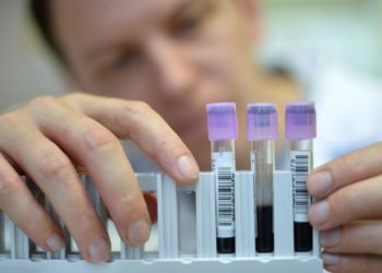 Un análisis de sangre podría predecir el párkinson siete años antes de los síntomas