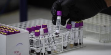 Un estudio abre la puerta a generar células madre en laboratorio para tratar la leucemia