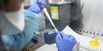 Argentina refuerza controles fronterizos ante la propagación de la viruela del mono