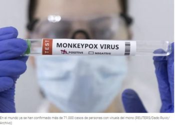 Ante casos de viruela del mono en Colombia y Brasil | MUV: Venezuela debe incluir a expertos en vigilancia epidemiológica