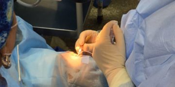 En Mérida realizan jornada quirúrgica para atender a 200 pacientes de cataratas