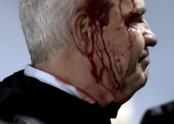 Infantino lamenta la agresión a Javier Aguirre: «No hay lugar para la violencia en el fútbol»