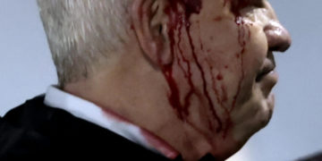 Infantino lamenta la agresión a Javier Aguirre: «No hay lugar para la violencia en el fútbol»