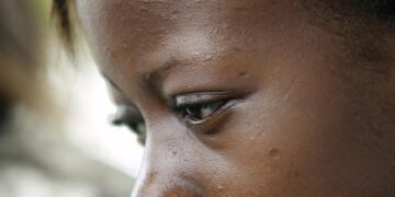 Las medidas de Trump ya se notan en África: cierran clínicas y falta tratamiento para VIH