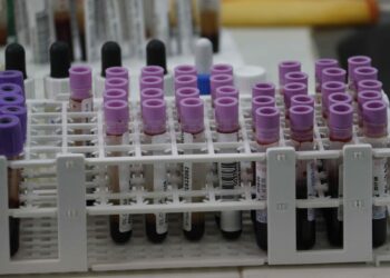 Una prueba de sangre basada en genes detecta signos tempranos de recaída en melanoma