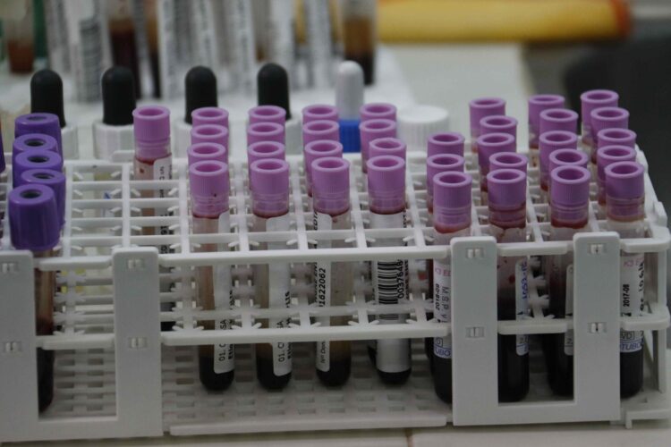 Imagen de archivo de muestras de sangre en un laboratorio. EFE/Andrés Cristaldo Benítez