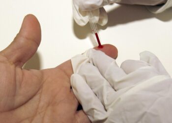 Desarrollan una inmunoterapia para revertir el daño cardíaco debido al colesterol