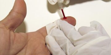 Desarrollan una inmunoterapia para revertir el daño cardíaco debido al colesterol