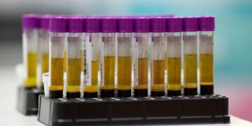 ONUSIDA pide que se mantenga la «solidaridad global» frente al VIH ante un dramático panorama