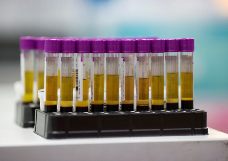 Imagen de archivo de muestras de sangre para test de VIH. EFE/ Rungroj Yongrit