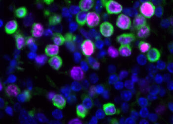 Virus respiratorios pueden despertar y promover la metástasis pulmonar del cáncer de mama