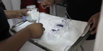 Vinculan el lupus con un virus que casi todos los humanos portan