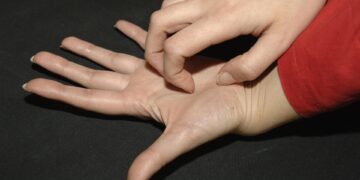 La piel: un reflejo del estrés