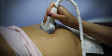 Un mecanismo genético en la formación de la placenta explica complicaciones en el embarazo