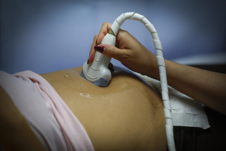 Fotografía de archivo de una mujer embarazada que se realiza una ecografía. EFE/ Francisco Guasco