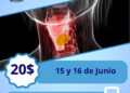 Sociedad Anticancerosa de Boconó invita a jornada de despistaje de cáncer de laringe 